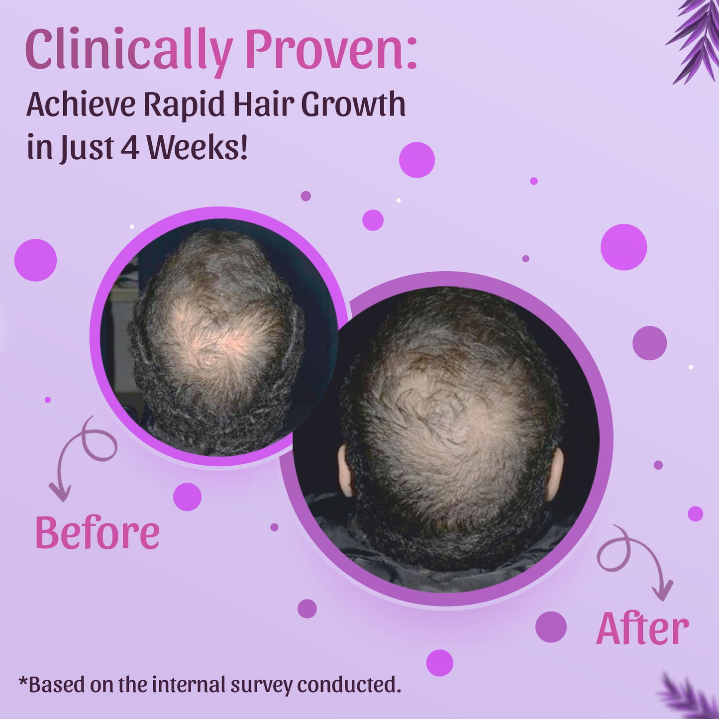 Rosemary Hair Oil, Shampoo & Hair Growth Spray