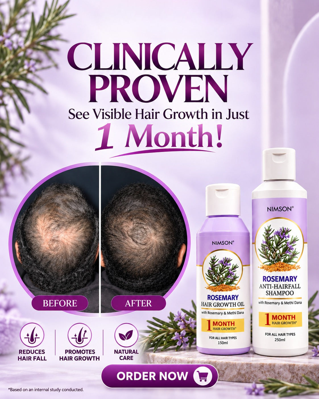 Nimson Rosemary Hair Care Combo – | Buy Pack of 2 Get 3 Free |  Rosemary Shampoo 250ml +  Rosemary Hair Growth Oil 150ml | Get Fruit Cream 50g + Petroleum Jelly 42ml + Rosemary Spray 110ml | For Men & Women